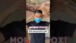 Apa itu penyakit monkeypox? 5 fakta penyakit mpox cacar monyet di Indonesia! 