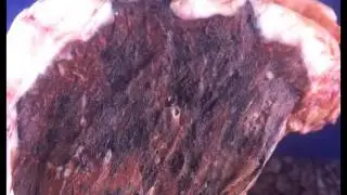 mesotheolima