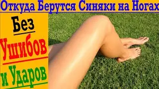 Откуда берутся синяки на коже без ушибов !