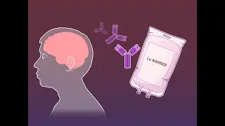 A Monoclonal Antibody for Migraine Prevention | NEJM