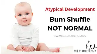 Atypical Development Baby Bum Shuffle 16 Months Old - What's Really Going On?!