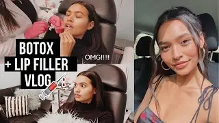 DRAMATIC LIP FILLER + BOTOX VLOG || NICOLE ELISE