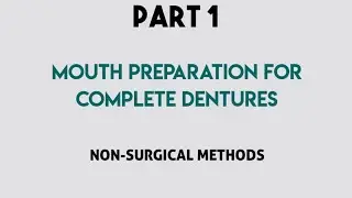 MOUTH PREPARATION FOR COMPLETE DENTURES :- PART 1 ( NON SURGICAL METHODS)