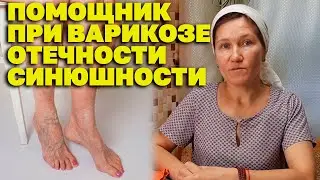 МОЩНОЕ СРЕДСТВО ОТ БОЛИ В НОГАХ ЭФФЕКТИВНОЕ ЛЕЧЕНИЕ ВАРИКОЗА  @natureMarusya