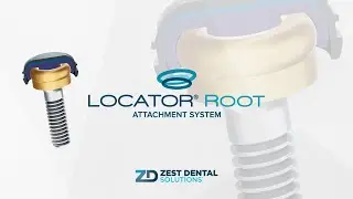 LOCATOR® Root Attachment System