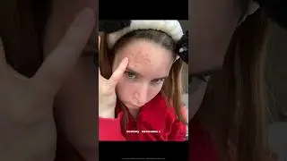 МАКИЯЖ ЧЕЛОВЕКА С АКНЕ 