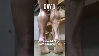 Insane 40 Day Calf Tear Recovery