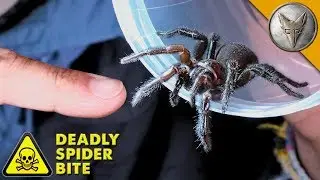 DEADLIEST SPIDER BITE!