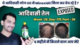 Adivasi Hair oil honest review | Adivasi Neelambari Herbal Hair Oil | Adivasi Hair Oil Review