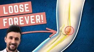 How to Permanently Loosen a Tight Ulnar Nerve