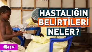 Acil Durum İlan Edildi! Maymun Çiçeği Nasıl Bulaşıyor? | NTV