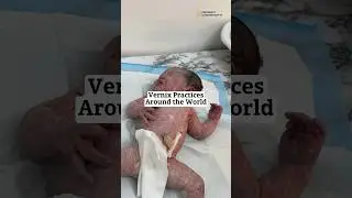 VERNIX Practices Around The 🌎!! (SO MUCH DISAGREEMENT OVER THIS)