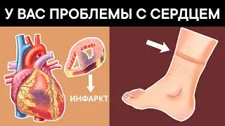 9 тревожных признаков того, что у Вас проблемы с СЕРДЦЕМ + ТОП 3 продукта для сердца