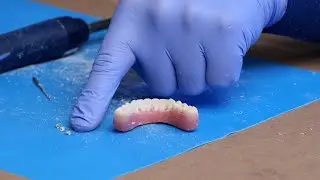 Create Screw Channels & Remove Peek Caps - Smart Denture Conversions Training