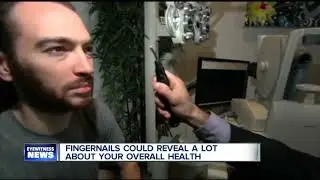 Do you have ridges or chips on your fingernails? You might want to talk to a doctor.