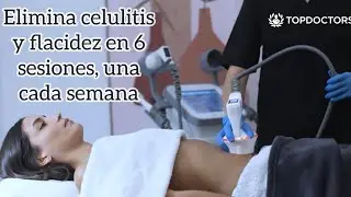 Radiofrecuencia para Eliminar Celulitis y Flacidez Corporal