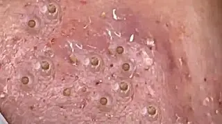 Most Satisfying and Relaxation with An Spa Video 