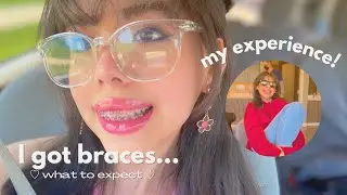 I GOT BRACES! ♡ (what to expect + my experience)
