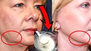 A STRONG MASK WILL TIGHTEN THE FACE IMMEDIATELY in 10 minutes JUST 1 Time a Week! Anti-Wrinkle Face