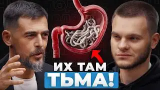 В ТЕБЕ ЖИВУТ ЧЕРВИ! Доктор Масгутов — Как ИЗБАВИТЬСЯ от ПАРАЗИТОВ?