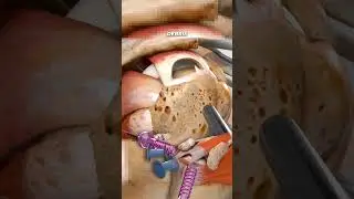 Rotator Cuff Shoulder Pain Relief #shorts