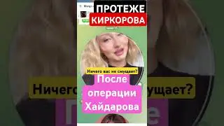 Протеже Киркорова после Пластики Хайдарова/вас ничего не смущает? 