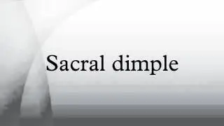 Sacral dimple