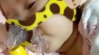 Kasian Masih Bayi Sudah Menderita 