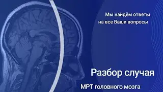МРТ головного мозга