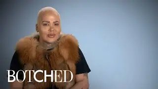 Jordan aka The Lip King Makes His Big Return! | Botched | E!