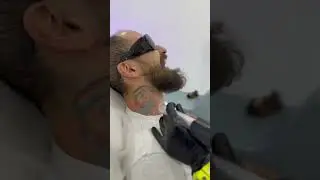 Удаляем тату Марио 🍄