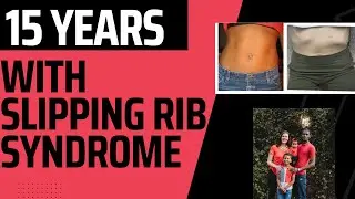 My Journey with Slipping Rib Syndrome, Surgery, and Recovery | Rib Pain