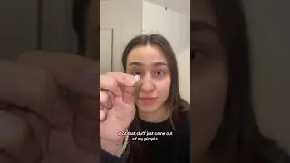 This came off my face???😱 