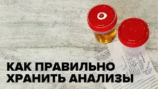 Сколько и как хранить анализы кала и мочи в холодильнике
