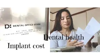 Trying to fix my insecurities|getting teeth implant in Japan,Cost,mental health