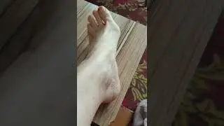 Результат таласо процедуры Ножки, как у младенца.