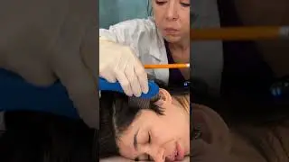 Asmr scalp tingles #asmr #asmrsounds #asmrvideo #relax #relaxing #satisfying #hair #sleep #tingles