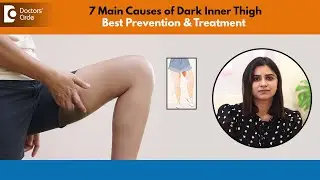 7 Causes of Dark Inner Thigh | How to Lighten Dark Inner Thighs FAST?-Dr.Nydile S V|Doctors' Circle