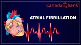 Atrial Fibrillation