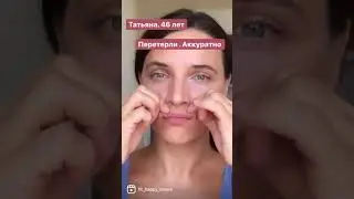 Убрать носогубки