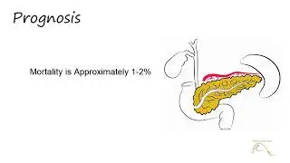 Pancreatitis - Part 2 of 2