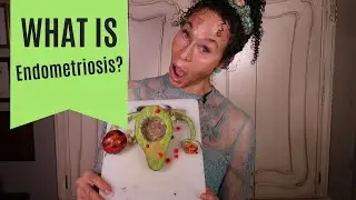 What Is Endometriosis? - 138