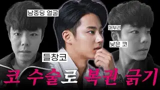 들창코만 내렸는데 홍대 접수해버린 사연 #남자코수술 #들창코
