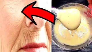 ANYTHING IS POSSIBLE! At the age of 60, I removed wrinkles with a face mask from wrinkles  Recipe