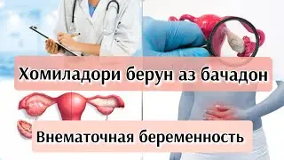 Хомиладори берун аз бачадон. Сабабҳои пайдоиш 