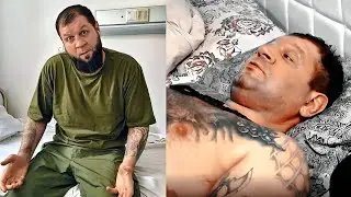 ALEXANDER EMELYANENKO HAD LEGS WITHOUT LEGS BECAUSE OF BLUEING