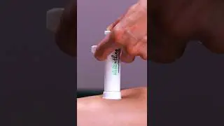 Say goodbye to itchy bug bites with this amazing device! 