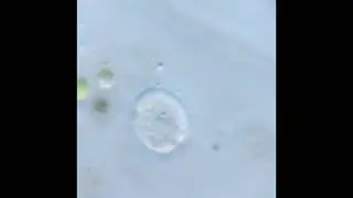 45 Minutes of Whatever This Microbe Is