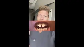 The TRUTH About Using Gap Bands On Your Teeth 😳 Orthodontist Reacts
