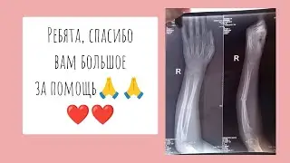 БЫЛИ У САГДЕЕВА. ОПЕРАЦИЯ БУДЕТ. ВЫРАЖАЮ ВСЕМ ОГРОМНУЮ БЛАГОДАРНОСТЬ🙏